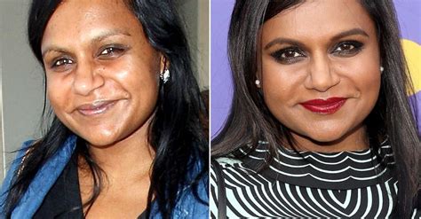 Mindy Kaling Plastic Surgery: Comparison of Before & After ...